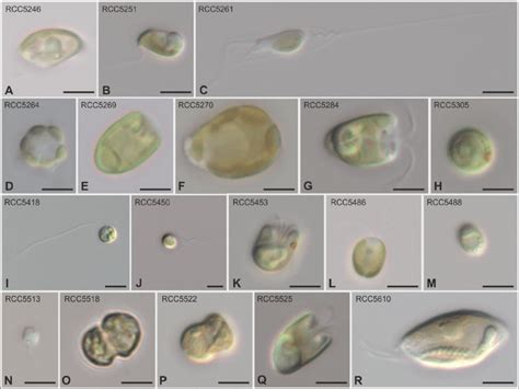  コリダクチウム：この海の鞭毛虫は一体何者なのか？